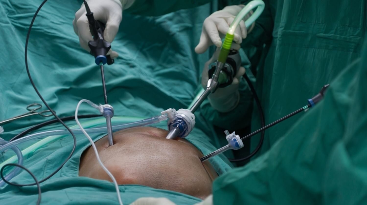 wmremove-transformed (31) wmremove-transformed (31)