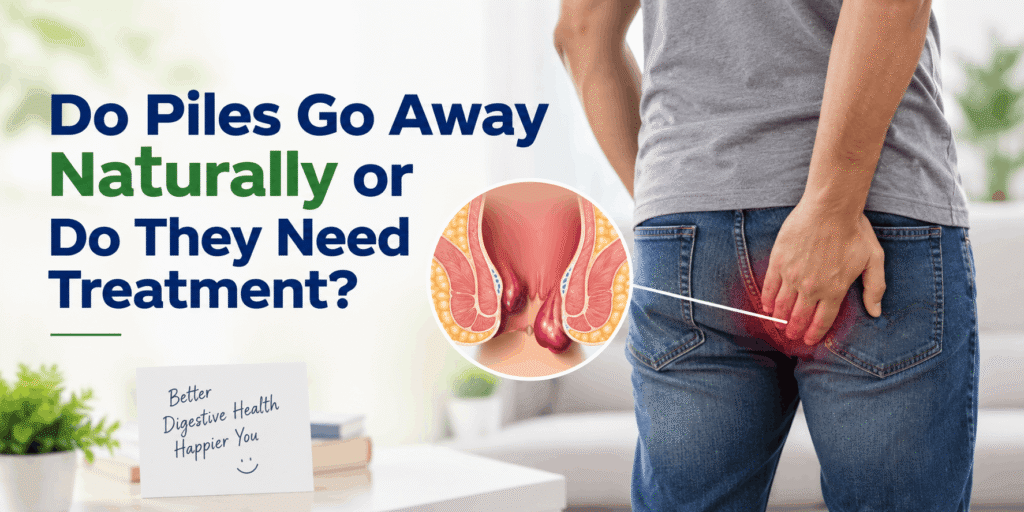Do Piles Go Away Naturally or Do They Need Treatment?